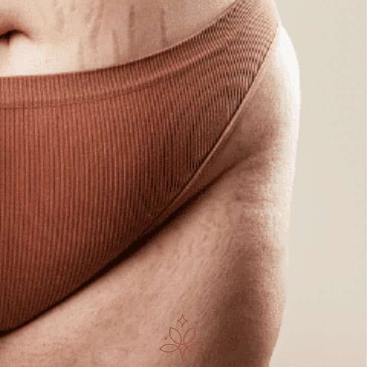 Avec les soins minceur Kera tu vas pouvoir… 1 1 1618525869422789 - Plomeur Pont L'Abbé Avec les soins minceur Kera tu vas pouvoir… 1 1 1618525869422789 - Plomeur Pont L'Abbé