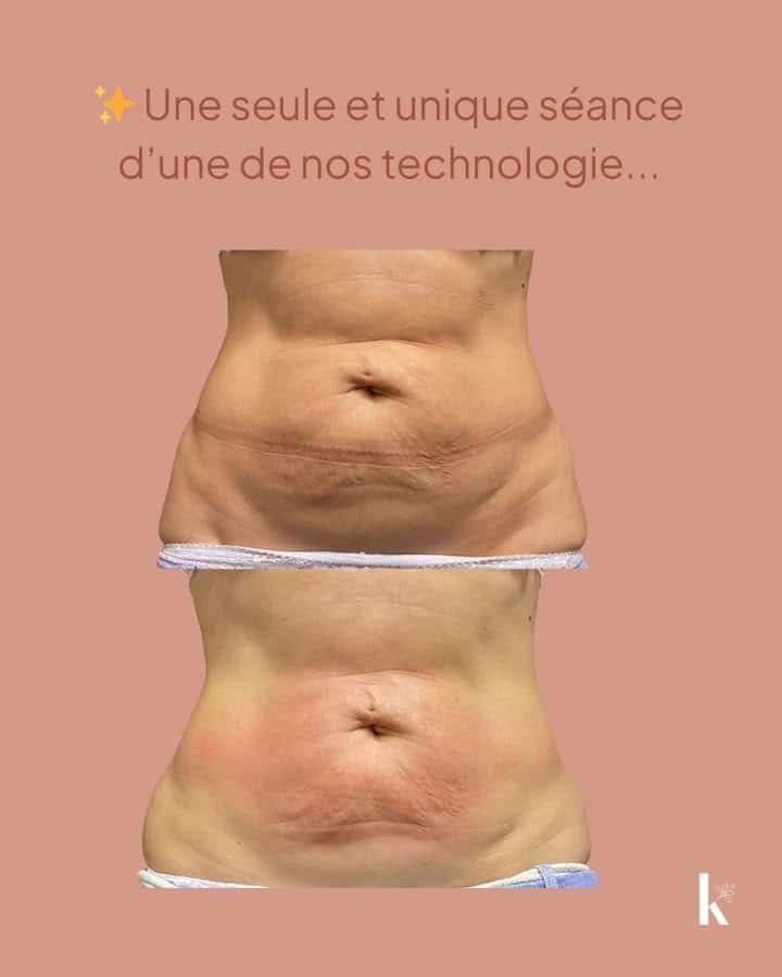 Une seance dune de nos technologie 1 1756369195638455 - Plomeur Pont L'Abbé Une seance dune de nos technologie 1 1756369195638455 - Plomeur Pont L'Abbé